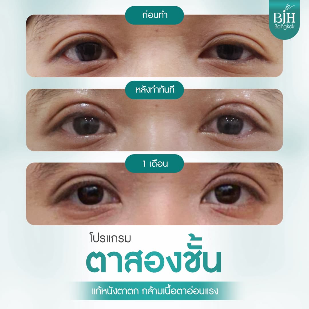 ตาสองชั้น 13