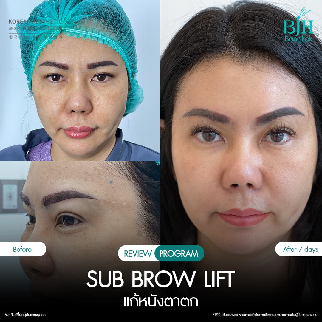 รีวิว Subbrowlift 04