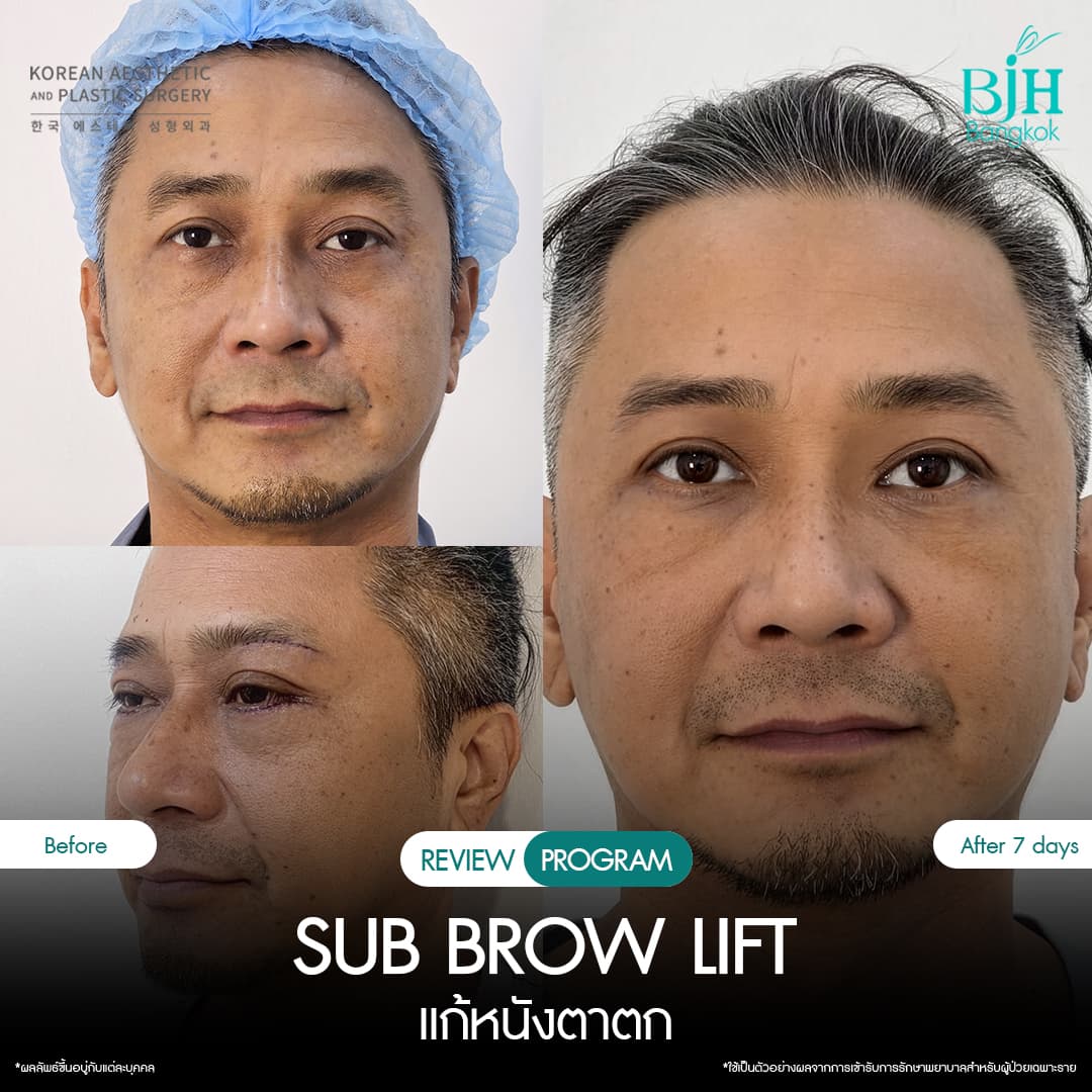 รีวิว Subbrowlift 02