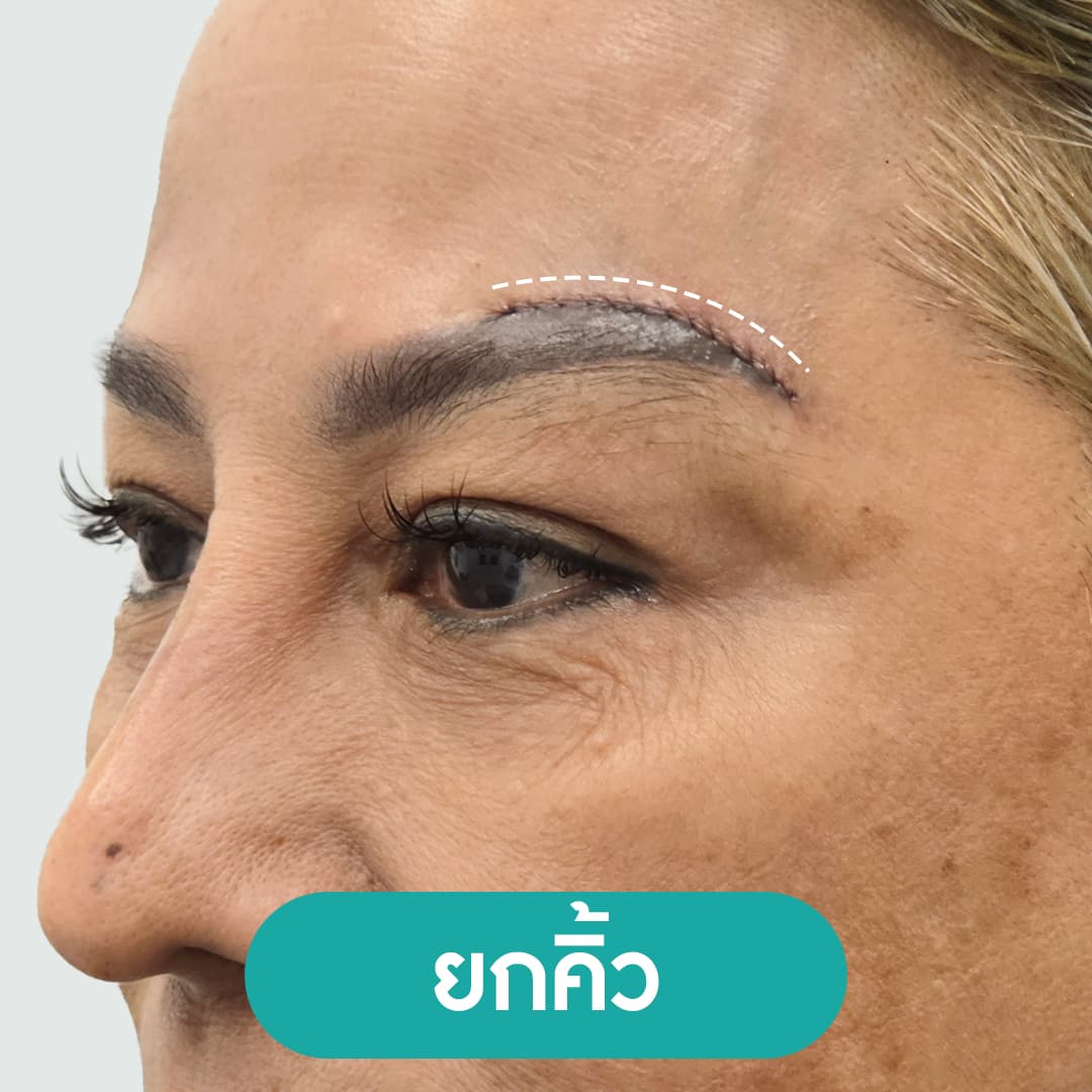 Artboard 10