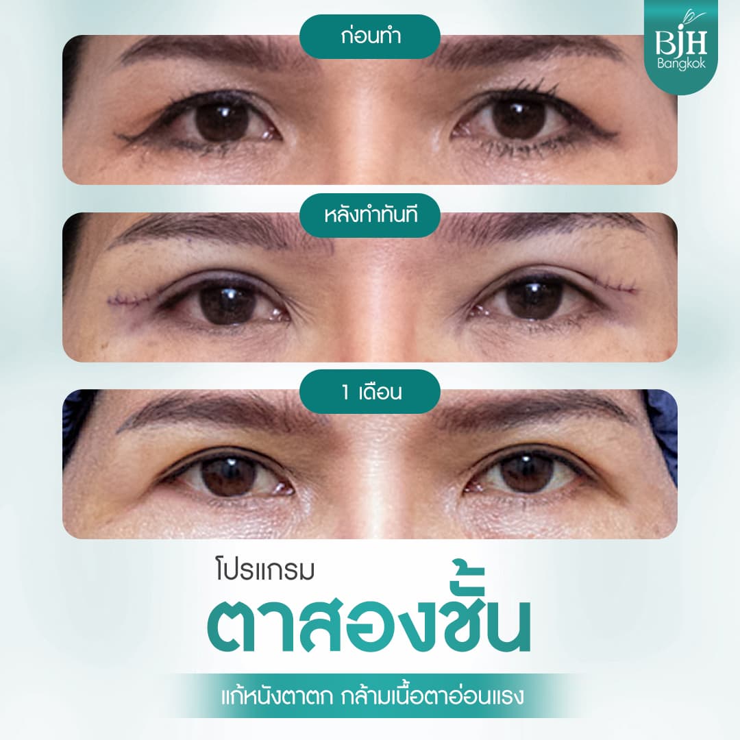 ตาสองชั้น 04