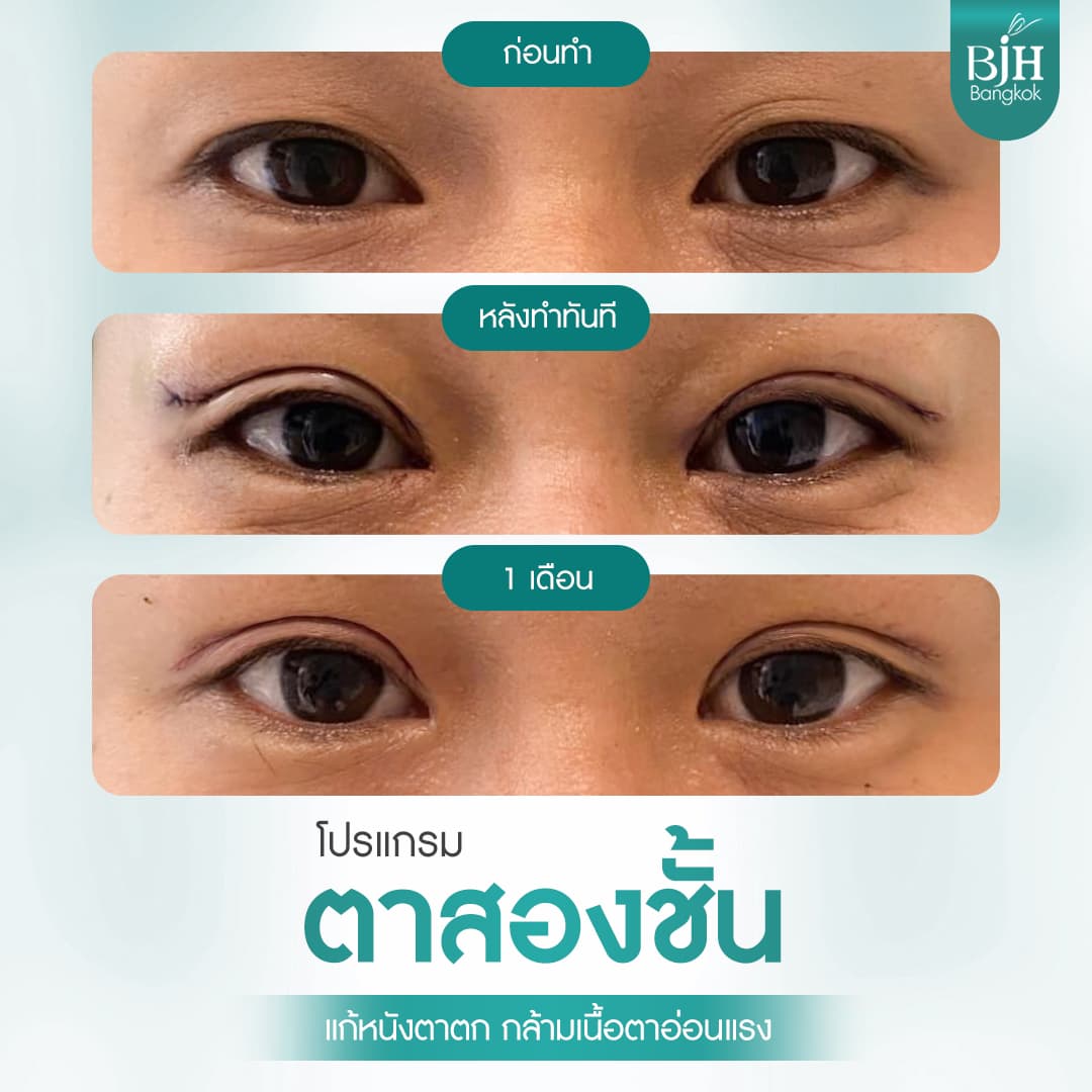 ตาสองชั้น 07