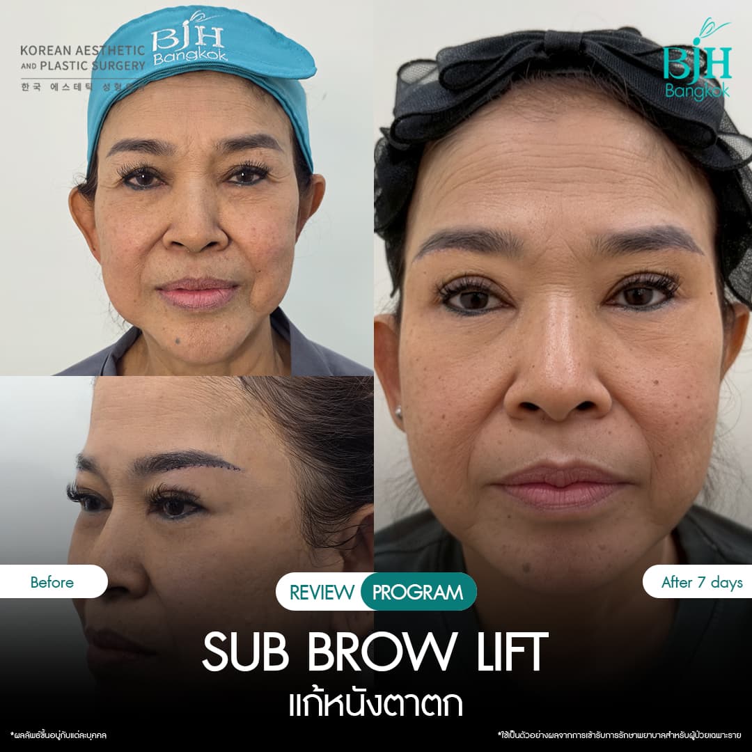 รีวิว Subbrowlift 07