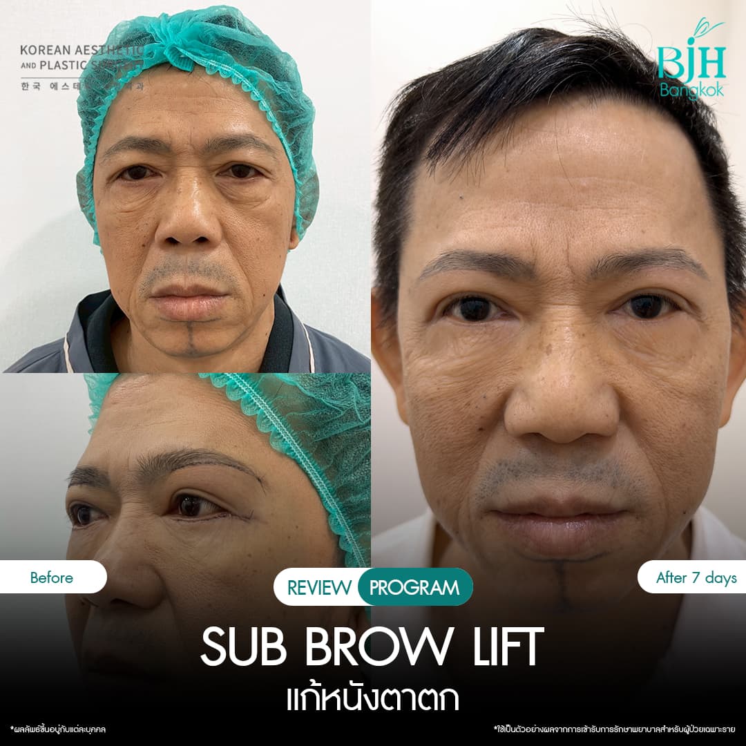 รีวิว Subbrowlift 08