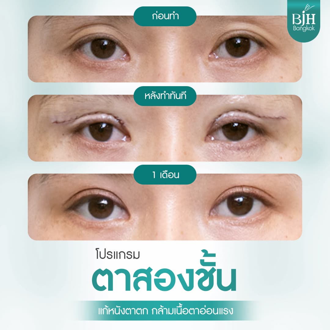 ตาสองชั้น 06
