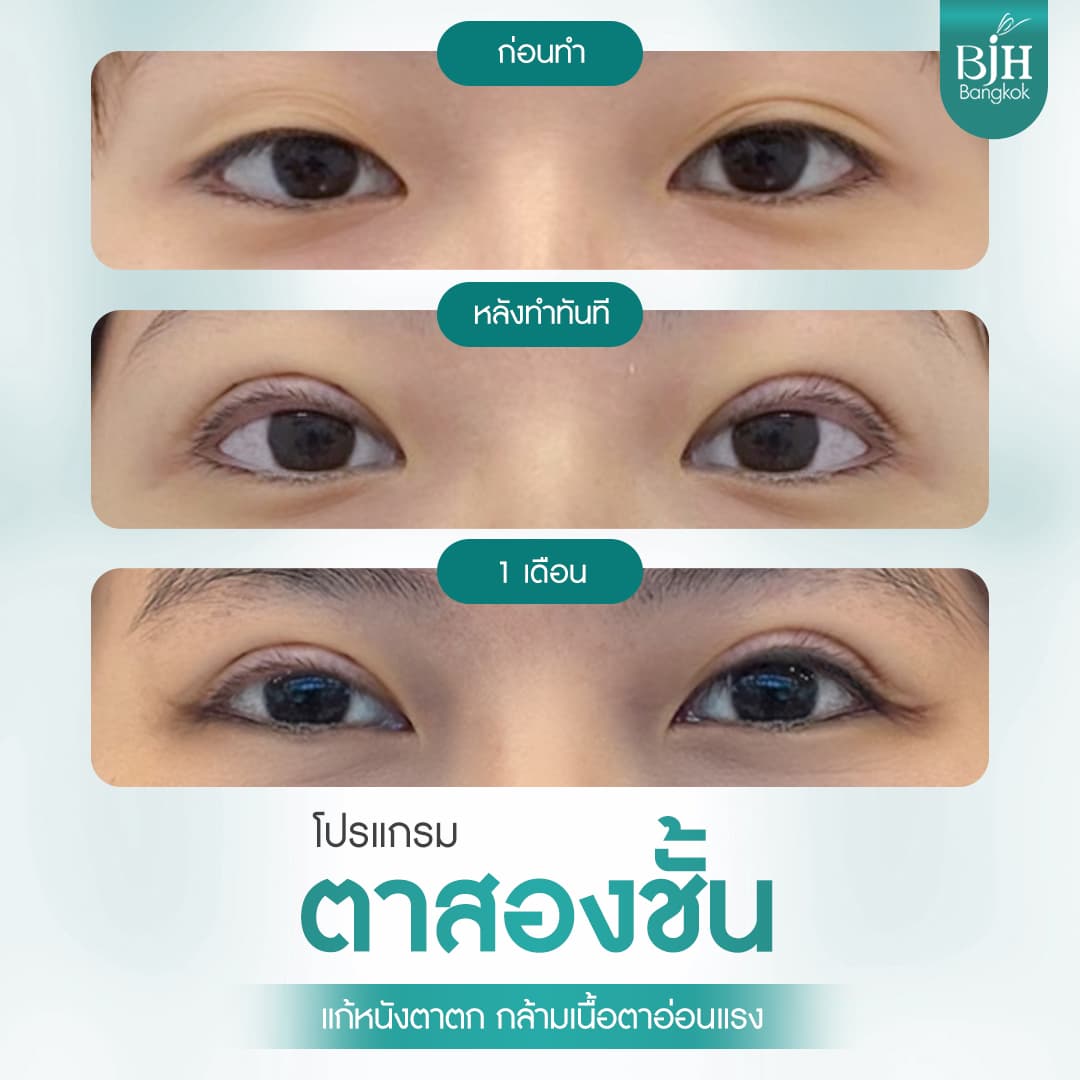 ตาสองชั้น 12