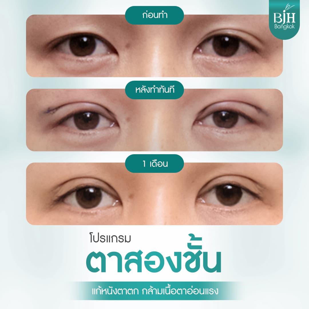 ตาสองชั้น 09