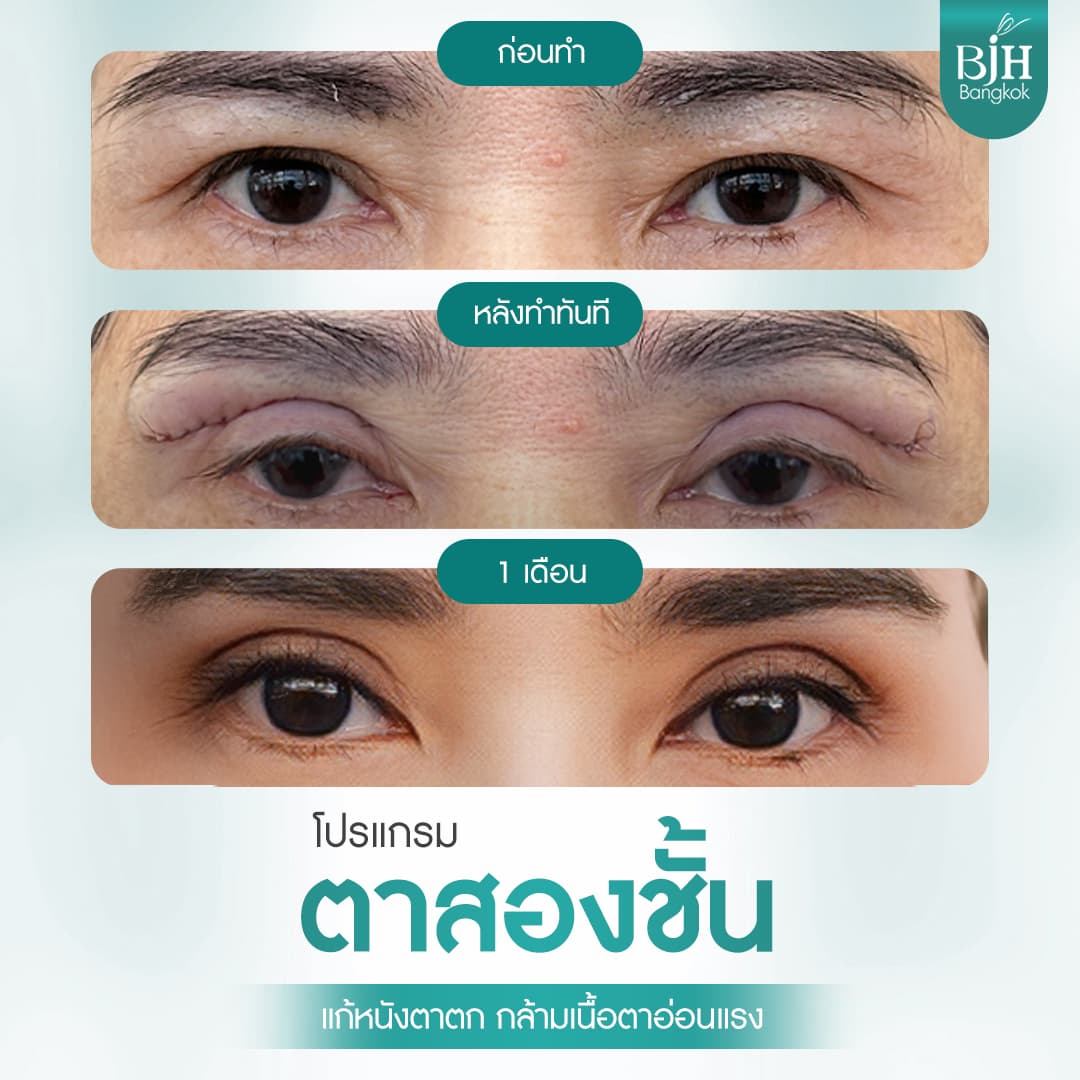 ตาสองชั้น 08