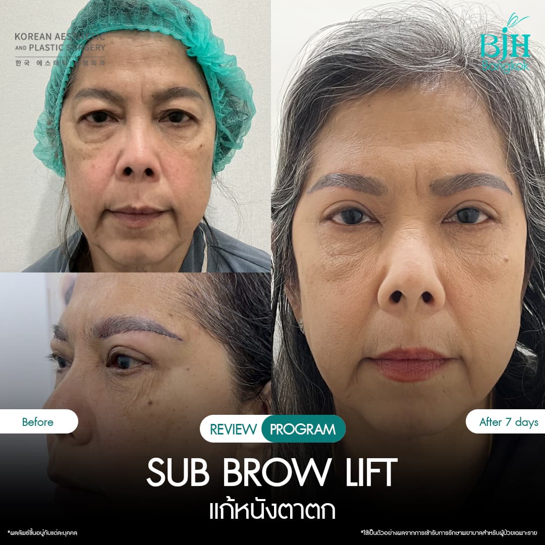 รีวิว Subbrowlift 06