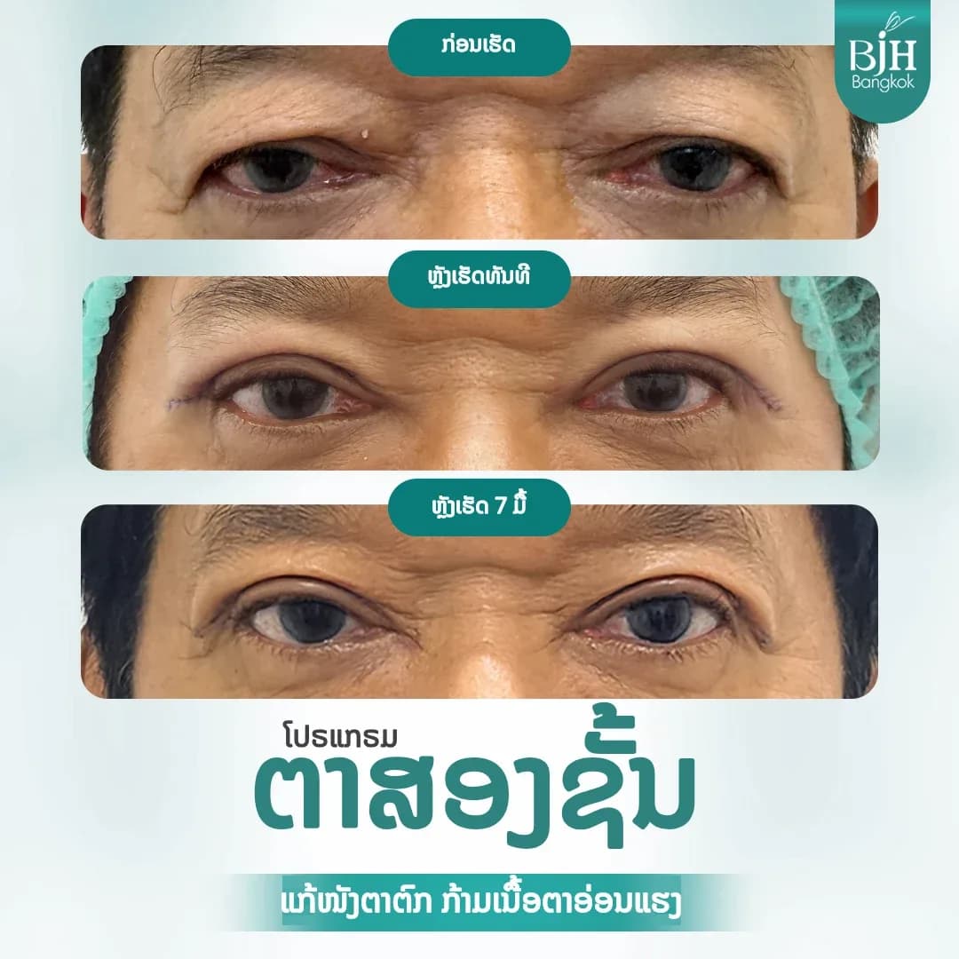 ตาสองชั้น 16