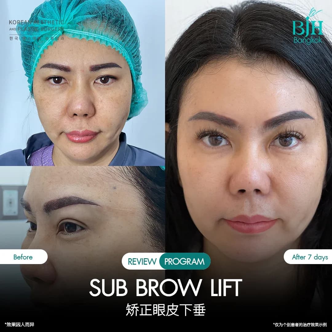 รีวิว Subbrowlift 04