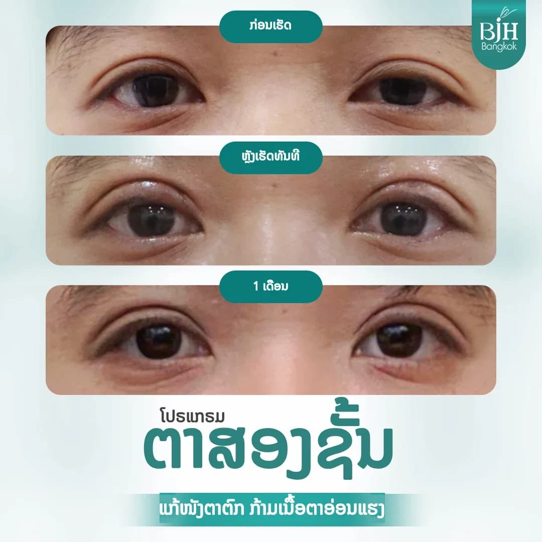 ตาสองชั้น 13