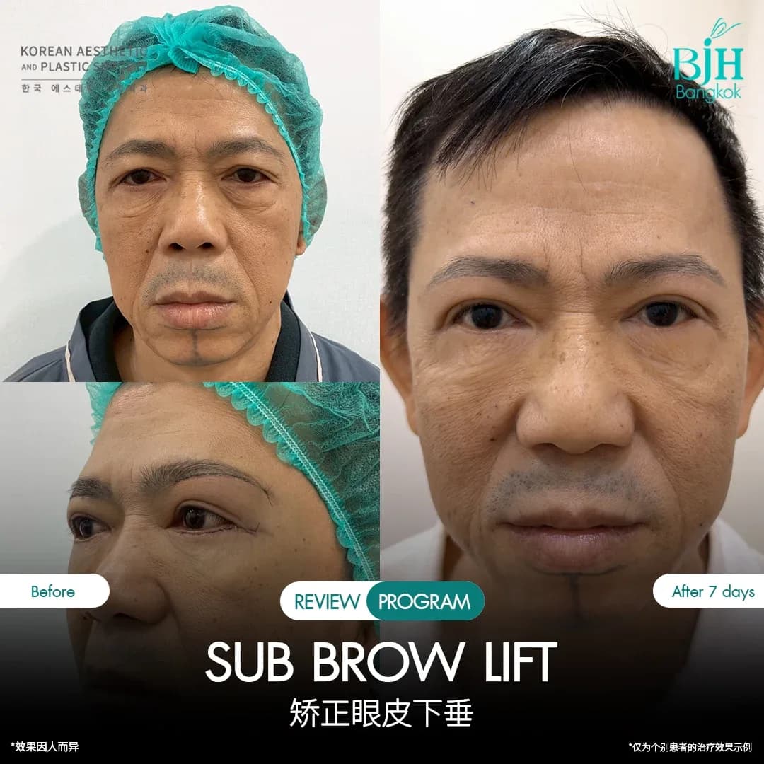 รีวิว Subbrowlift 08