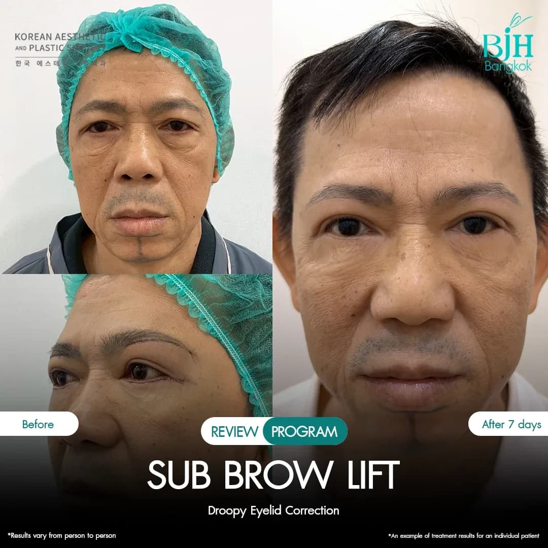 รีวิว Subbrowlift 08