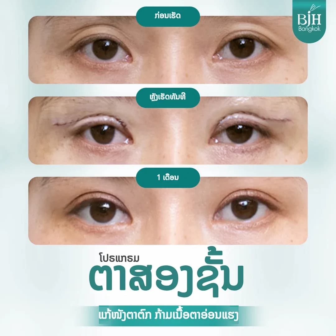 ตาสองชั้น 06