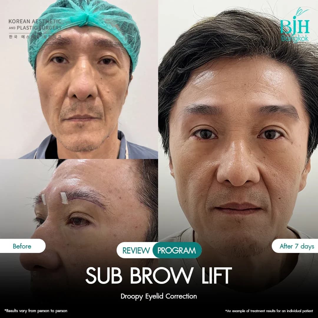 รีวิว Subbrowlift 05