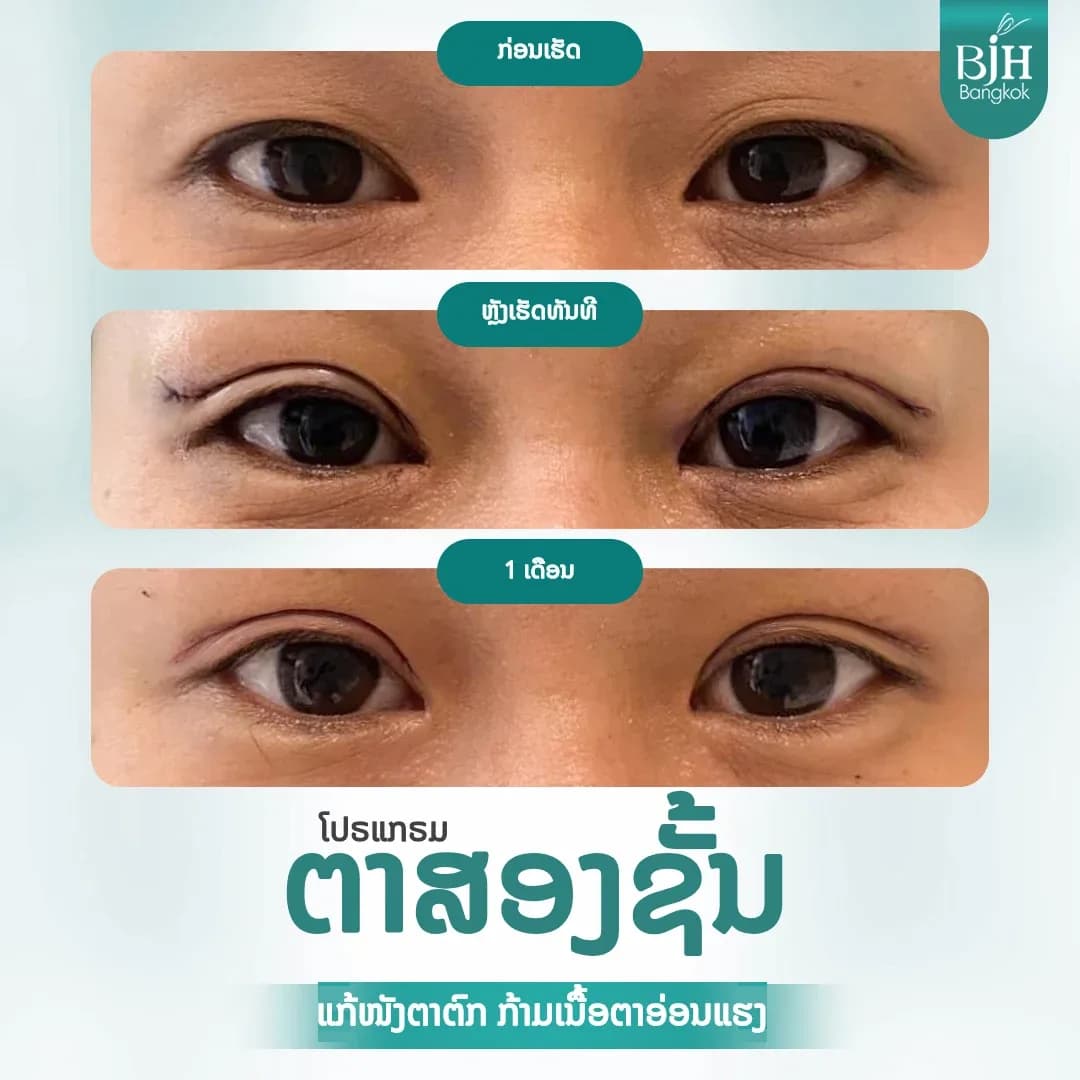 ตาสองชั้น 07