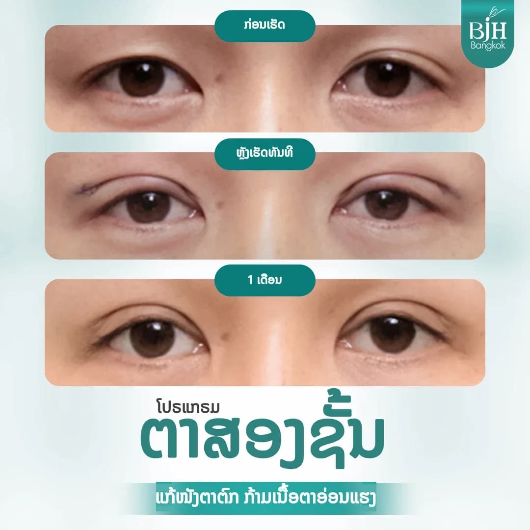 ตาสองชั้น 09