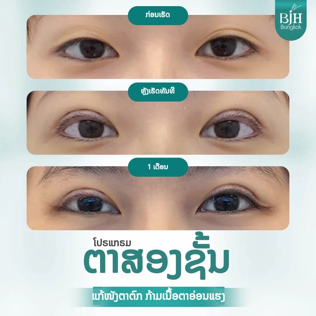 ตาสองชั้น 12