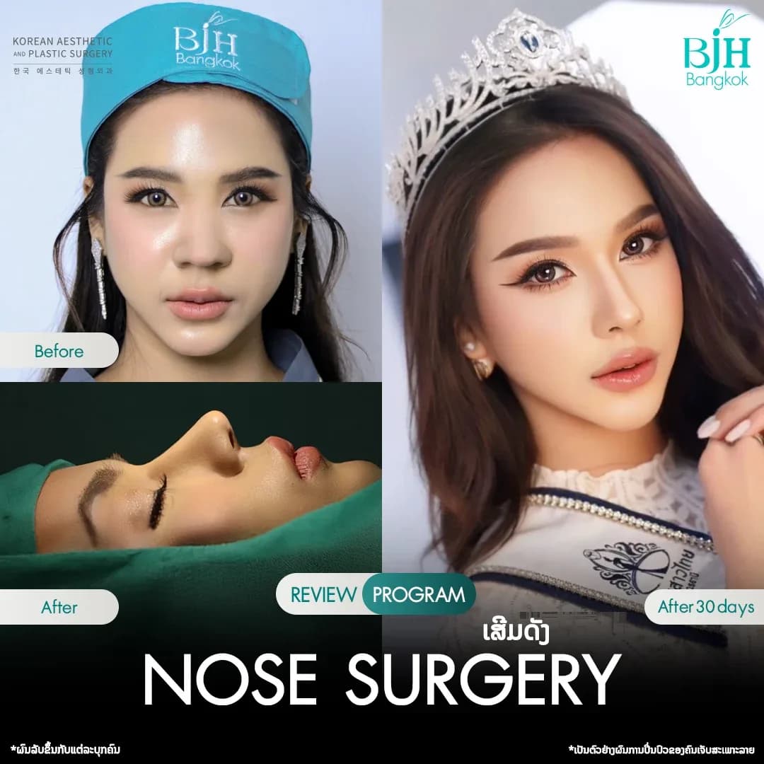 รีวิวเสริมจมูก 9