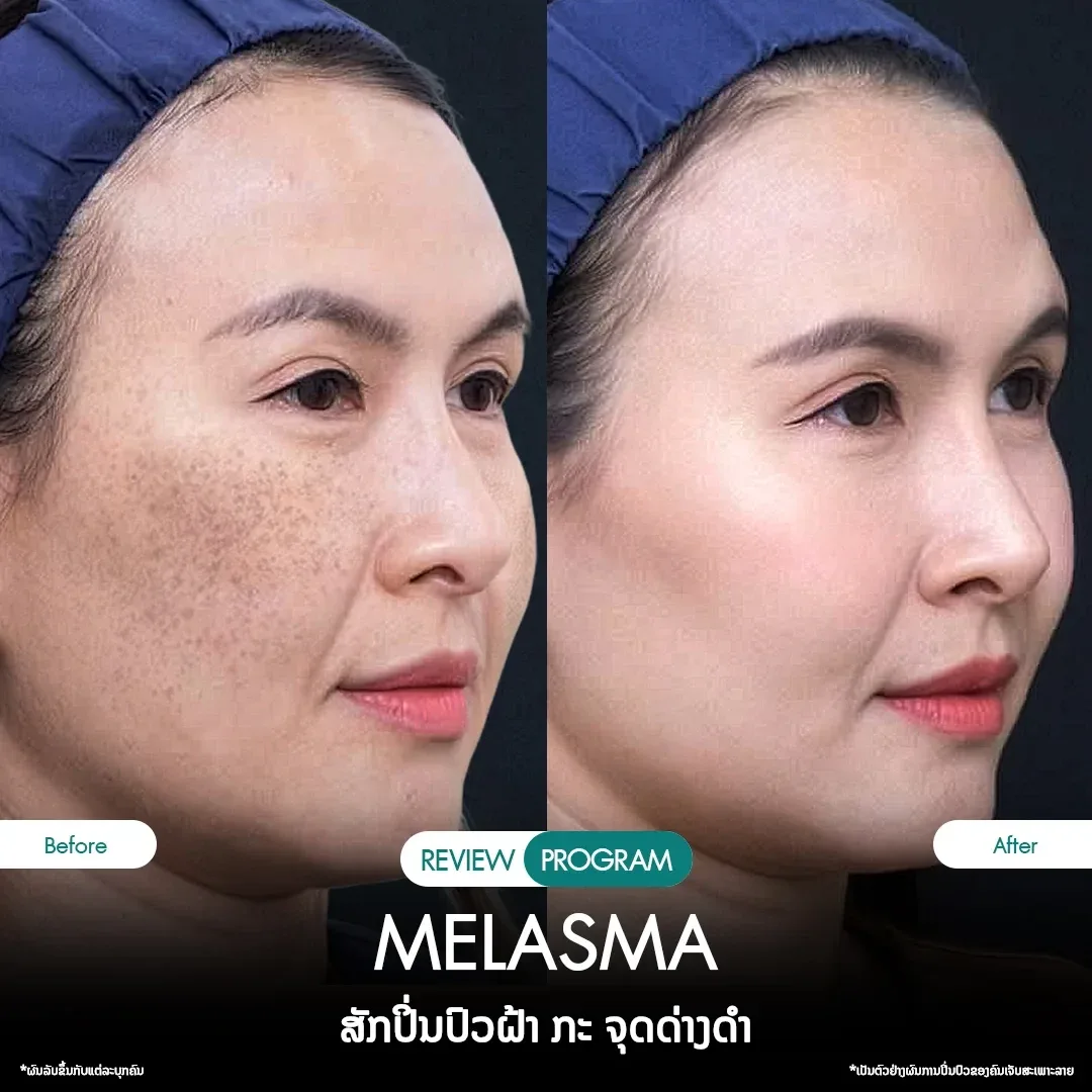 review-11