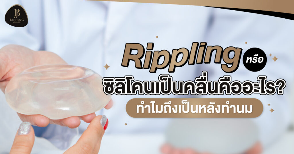 Rippling หรือ ซิลิโคนเป็นคลื่น หลังทำนม คืออะไร?