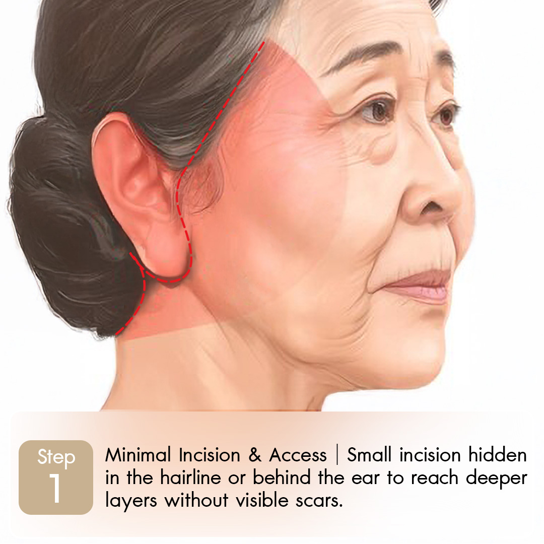 Knoledge Lowerface-01