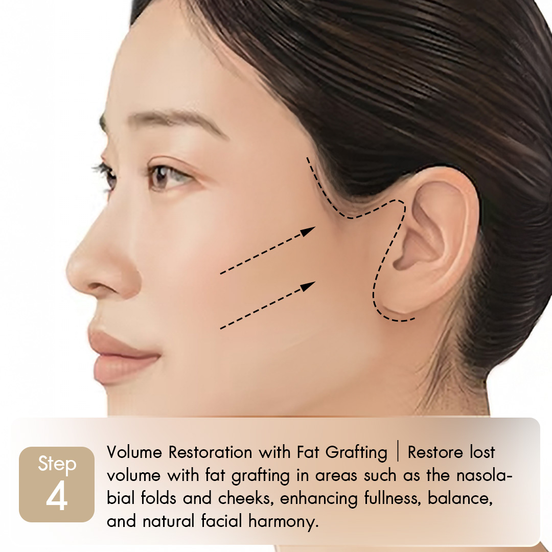 Knoledge Midface-04